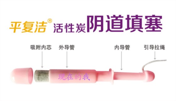 活性炭陰道填塞 活性炭陰道填塞