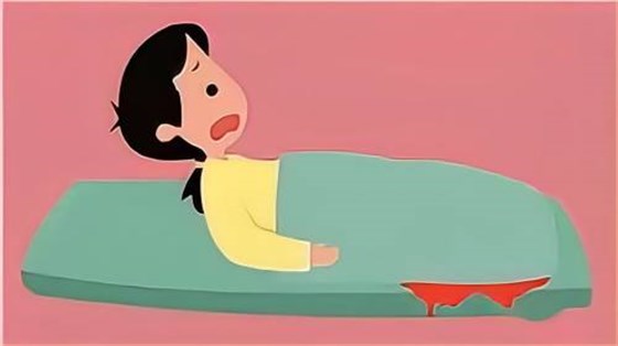 產后出血2 產后出血2